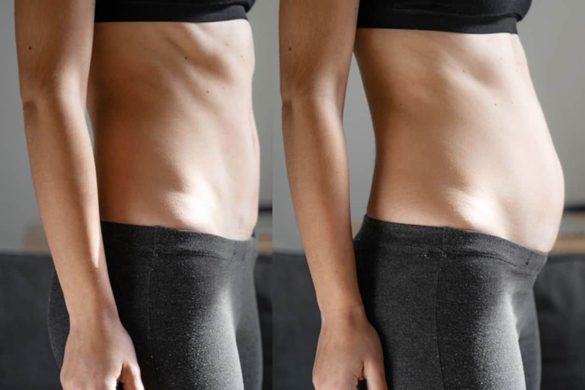 How long does diastasis recti take to improve Essex?