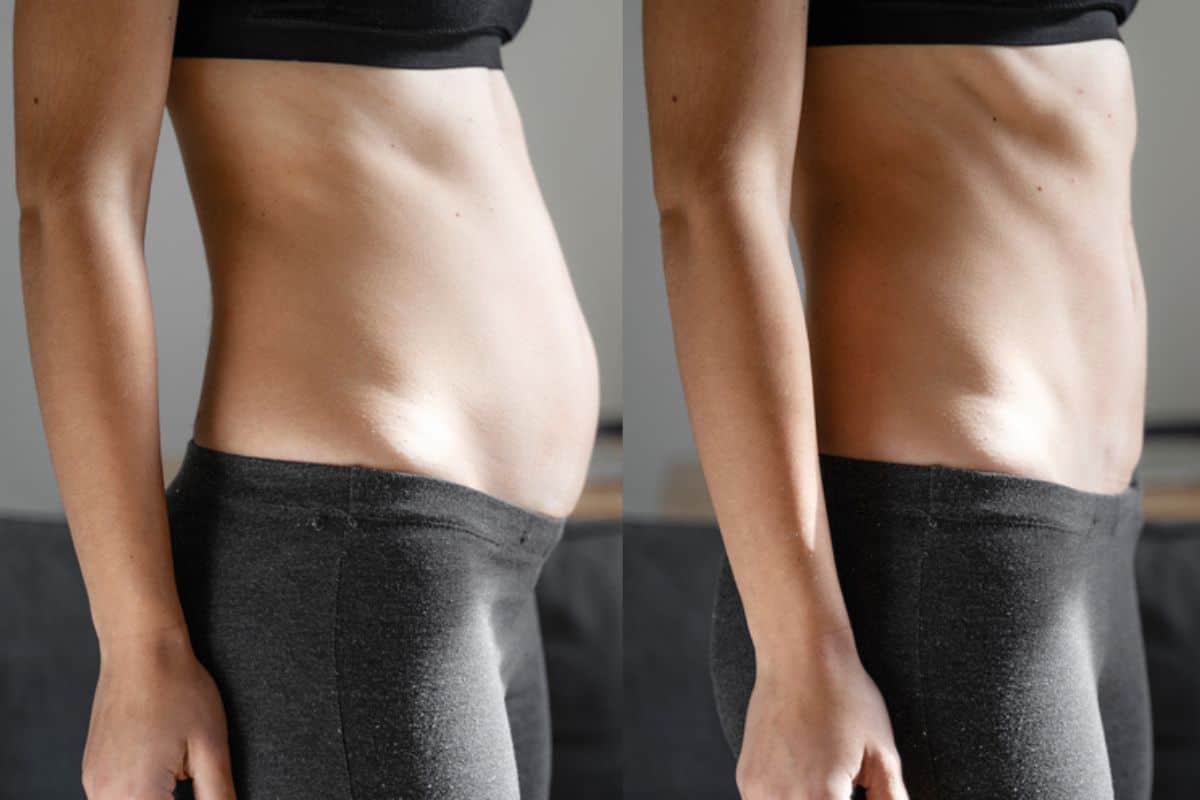 Post-Pregnancy: What Happens to Your Abdominal Muscles After Birth Essex
