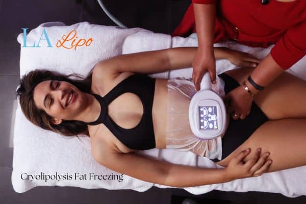 woman getting cryolipolysis Essex