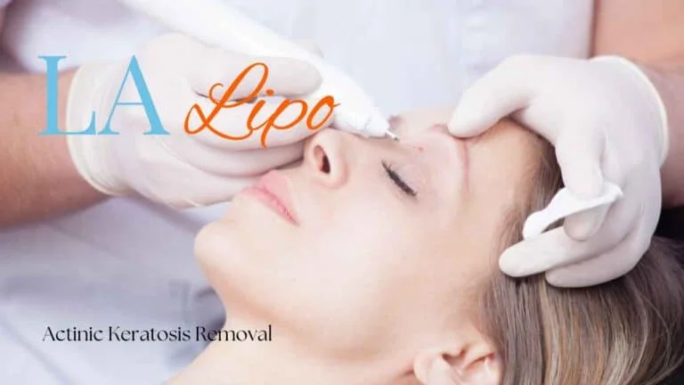 Woman receiving Actinic Keratosis Removal Treatment Essex