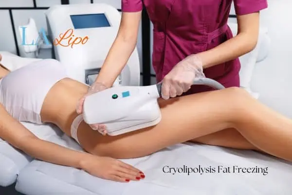 Woman receiving coolsculpting Essex treatment on her thighs