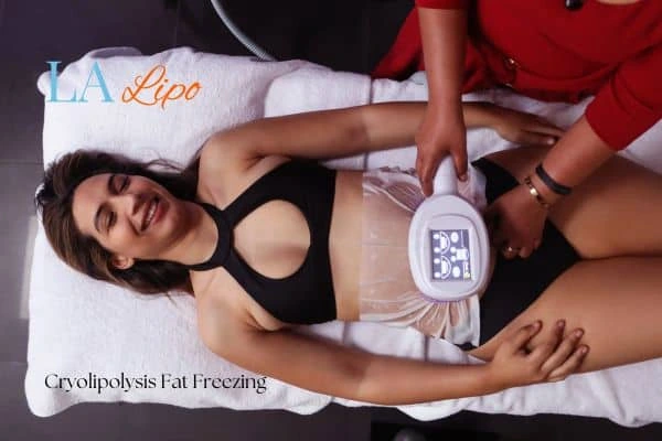 woman getting cryolipolysis Essex