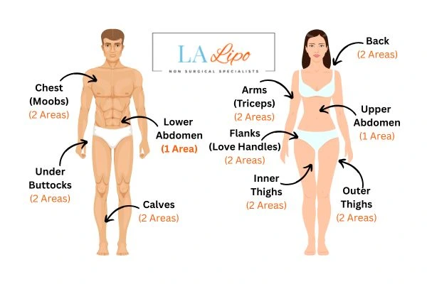 LA LIPO Cryolipolysis Areas Essex