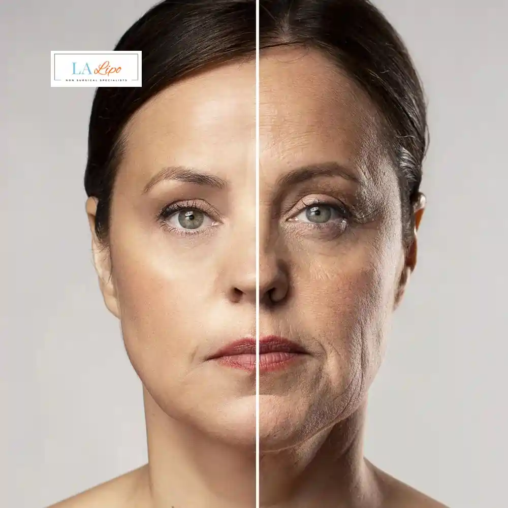 How Can You Tell If Non-Surgical Skin Tightening Is Right for You Essex?