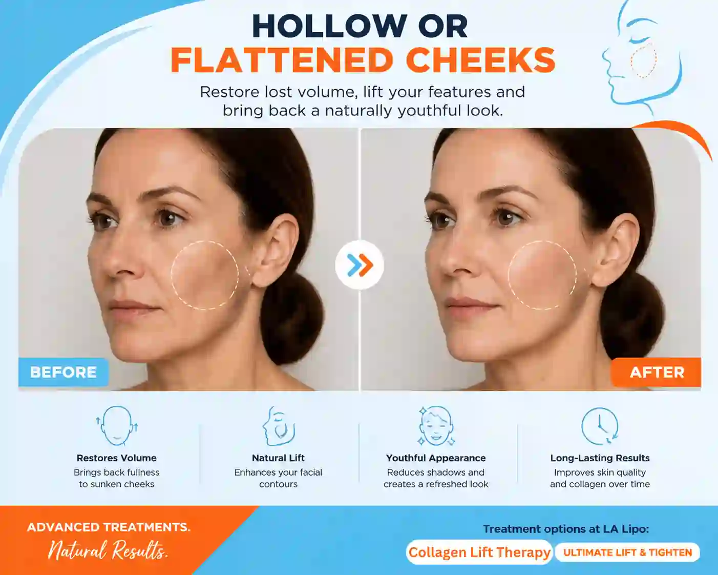 Sign #4: Hollow or Flattened Cheeks Essex