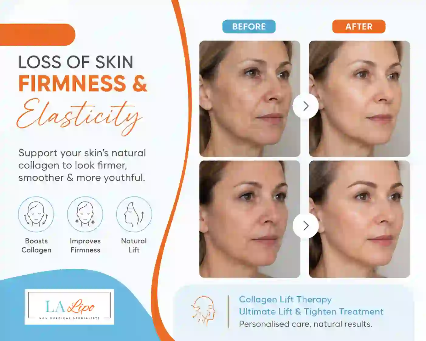 Sign #7: Loss of Skin Firmness and Elasticity Essex